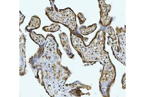 IHC analysis of ACLY using anti-ACLY antibody (ABIN4886416).