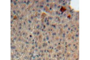 Used in DAB staining on fromalin fixed paraffin-embedded Liver tissue