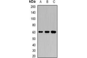 Western blot analysis of Karyopherin alpha-6 expression in BT474 (A), SW620 (B), mouse testis (C) whole cell lysates. (KPNA6 anticorps)