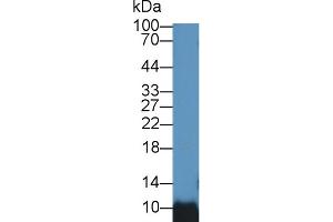 Detection of BANF1 in Rat Testis lysate using Polyclonal Antibody to Barrier To Autointegration Factor 1 (BANF1)