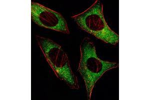 Fluorescent image of Hela cell stained with PRK Antibody (ABIN659096 and ABIN2838081)/SG110126.