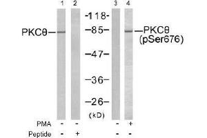 Image no. 2 for anti-Protein Kinase C, theta (PRKCQ) (pSer676) antibody (ABIN197071) (PKC theta anticorps  (pSer676))