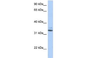 WB Suggested Anti-SULT1A1 Antibody Titration:  0. (SULT1A1 anticorps  (N-Term))