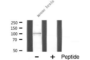 Western blot analysis of HXK1 expression in Mouse brain lysate (Hexokinase 1 anticorps  (N-Term))