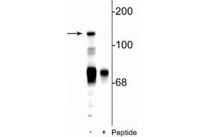 Western blot of rat cerebellar lysate showing specific immunolabeling of the ~140 kDa NR2C subunit of the NMDA receptor phosphorylated at Ser1244 in the first lane (-). (GRIN2C anticorps  (pSer1244))