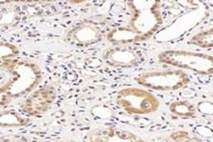 Immunohistochemistry analysis of paraffin-embedded human para-cancer kidney using NCKAP1 (ABIN7074784) at dilution of 1: 8000