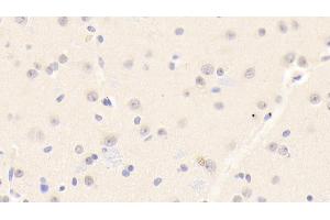 Detection of PRDX6 in Human Cerebrum Tissue using Polyclonal Antibody to Peroxiredoxin 6 (PRDX6)