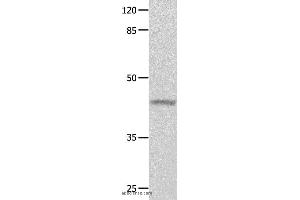 Western blot analysis of Mouse eyes tissue, using GNA11 Polyclonal Antibody at dilution of 1:550