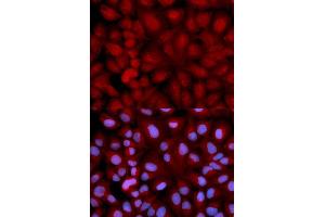 Immunofluorescence analysis of U2OS cell using SNCG antibody. (SNCG anticorps  (AA 1-127))