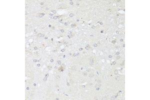 Immunohistochemistry of paraffin-embedded rat brain using CASP3 antibody. (Caspase 3 anticorps  (AA 55-160))
