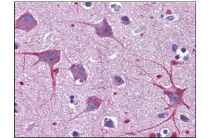 Human Brain, Cortex: Formalin-Fixed, Paraffin-Embedded (FFPE) (SKA1 anticorps  (C-Term))