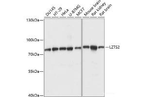 Western blot analysis of extracts of various cell lines using LZTS2 Polyclonal Antibody at dilution of 1:1000. (LZTS2 anticorps)