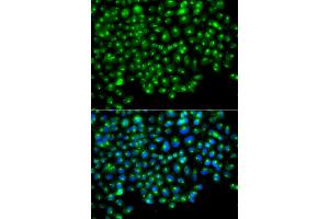 Immunofluorescence analysis of A549 cells using GOPC antibody (ABIN6292960). (GOPC anticorps)