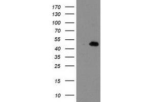 Western Blotting (WB) image for anti-Aryl Hydrocarbon Receptor Interacting Protein-Like 1 (AIPL1) antibody (ABIN1496508) (AIPL1 anticorps)