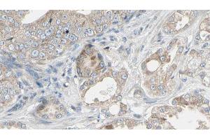 ABIN6268943 at 1/100 staining Human prostate tissue by IHC-P. (TRAF1 anticorps  (C-Term))