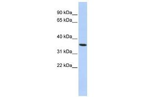 PAQR6 antibody used at 1 ug/ml to detect target protein. (PAQR6 anticorps  (N-Term))