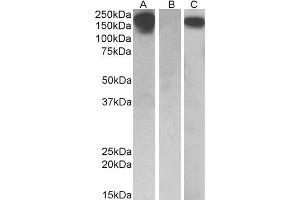 HEK293 lysate (10ug protein in RIPA buffer) overexpressing Human CSF1R with C-terminal MYC tag probed with ABIN571221 (0. (CSF1R anticorps  (AA 700-710))