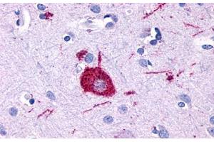 Anti-GPR116 antibody  ABIN1048696 IHC staining of human brain, neuron. (G Protein-Coupled Receptor 116 anticorps  (Cytoplasmic Domain))