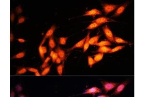 Immunofluorescence analysis of NIH-3T3 cells using KAT2A Polyclonal Antibody at dilution of 1:100 (40x lens).