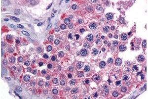 Human Testis: Formalin-Fixed, Paraffin-Embedded (FFPE) (MIA3 anticorps  (AA 1-120))