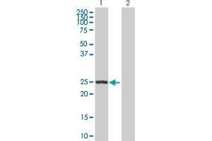 Western Blot analysis of ARHGDIB expression in transfected 293T cell line by ARHGDIB MaxPab polyclonal antibody. (ARHGDIB anticorps  (AA 1-201))