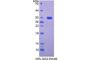 Image no. 1 for Basigin (Ok Blood Group) (BSG) (AA 59-321) protein (T7 tag,His tag) (ABIN6237735)