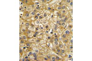 Immunohistochemistry (IHC) image for anti-Adiponectin Receptor 1 (ADIPOR1) antibody (ABIN3003843)