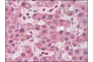 Image no. 1 for anti-Pyruvate Carboxylase (PC) (Internal Region) antibody (ABIN372799) (PC anticorps  (Internal Region))