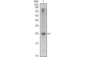 Western Blot showing NKX3A antibody used against LNCaP (1) cell lysate. (NKX3-1 anticorps)