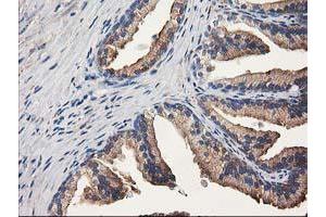 Immunohistochemistry (IHC) image for anti-Aldehyde Dehydrogenase 1 Family, Member A3 (ALDH1A3) (AA 1-100), (AA 413-512) antibody (ABIN2715886) (ALDH1A3 anticorps  (AA 1-100, AA 413-512))