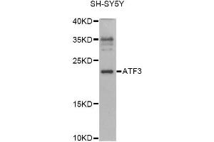 Western blot analysis of extracts of SH-SY5Y cells, using ATF3 antibody (ABIN6290025) at 1:1000 dilution. (ATF3 anticorps)