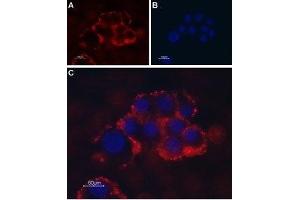 Expression of TRPC1 in PC12 cells - Cell surface detection of TRPC1 in intact living PC12 cells.