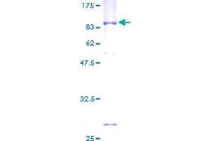 Image no. 1 for TROVE Domain Family, Member 2 (TROVE2) (AA 1-538) protein (GST tag) (ABIN1323809) (TROVE2 Protein (AA 1-538) (GST tag))
