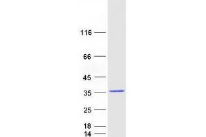 Validation with Western Blot