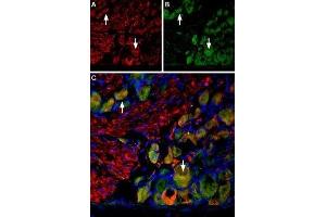 Multiplex staining of VGLUT2 and Neurokinin 1 Receptor in rat DRG - Immunohistochemical staining of perfusion-fixed frozen rat dorsal root ganglion (DRG) sections using Anti-VGLUT2-ATTO Fluor-594 Antibody (ABIN7043682), (1:60) and Anti-Neurokinin 1 Receptor (NK1R) (extracellular)-ATTO Fluor-488 Antibody (ABIN7043804), (1:60). (TACR1 anticorps  (2nd Extracellular Loop) (Atto 488))