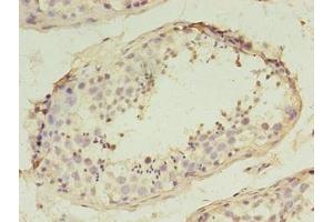 Immunohistochemistry of paraffin-embedded human testis tissue using ABIN7170468 at dilution of 1:100 (SPANXD anticorps  (AA 1-97))