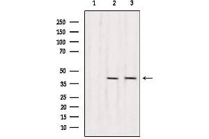 Western blot analysis of extracts from various samples, using RBM4 Antibody. (RBM4 anticorps  (Internal Region))