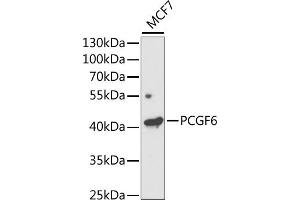 Western blot analysis of extracts of MCF7 cells, using PCGF6 antibody (ABIN6131076, ABIN6145311, ABIN6145312 and ABIN6221435) at 1:1000 dilution. (PCGF6 anticorps  (AA 161-350))