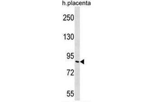 GP111 Antibody (Center) western blot analysis in human placenta tissue lysates (35µg/lane). (GP111 anticorps  (Middle Region))