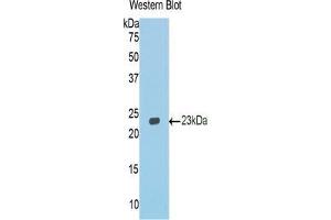 Western blot analysis of the recombinant protein.