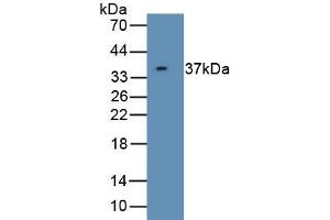 Detection of Recombinant CDK5, Human using Polyclonal Antibody to Cyclin Dependent Kinase 5 (CDK5) (CDK5 anticorps  (AA 1-292))