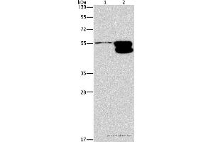Western blot analysis of NIH/3T3 cell and mouse brain tissue, using CRHR2 Polyclonal Antibody at dilution of 1:650 (CRHR2 anticorps)