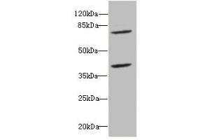 Western blot All lanes: CBFA2T2antibody at 2. (CBFA2T2 anticorps  (AA 325-604))