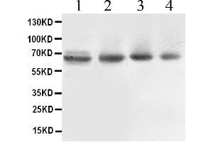 Western blot analysis of ABCB10 expression in rat cardiac muscle extract ( Lane 1), COLO320 whole cell lysates ( Lane 2), 22RV1 whole cell lysates ( Lane 3) and PANC whole cell lysates ( Lane 4). (ABCB10 anticorps  (C-Term))