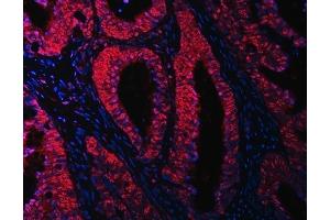 IF analysis of RBM15B using anti-RBM15B antibody (ABIN7600219). (RBM15B anticorps  (AA 164-890))