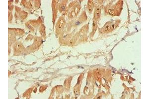 Immunohistochemistry of paraffin-embedded human heart tissue using ABIN7146531 at dilution of 1:100 (CAPNL1 anticorps  (Catalytic Subunit))