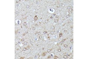 Immunohistochemistry of paraffin-embedded rat brain using N-WASP/WASL antibody (ABIN3016273, ABIN3016274, ABIN3016275, ABIN1683282 and ABIN6219682) at dilution of 1:100 (40x lens). (Neural Wiskott-Aldrich syndrome protein (WASL) (AA 1-250) anticorps)