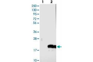 Western blot analysis of Lane 1: Negative control (vector only transfected HEK293T lysate), Lane 2: Over-expression Lysate (Co-expressed with a C-terminal myc-DDK tag (~3. (C14ORF177 anticorps)