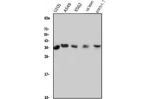 Western blot analysis of MED4 using anti-MED4 antibody (ABIN7600817). (MED4 anticorps  (AA 24-254))