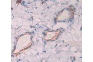 Used in DAB staining on fromalin fixed paraffin- embedded Kidney tissue
